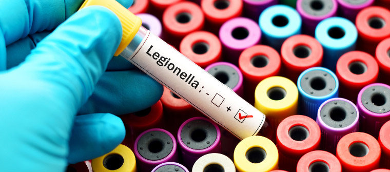 Qué es la legionella